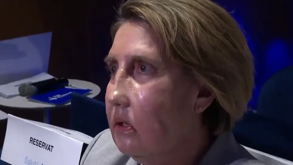 Трансплантација лица