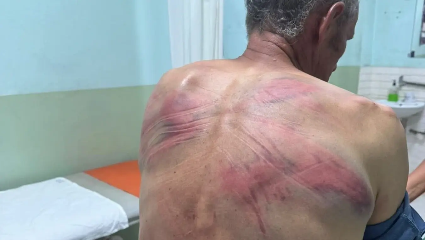 претукли Ненада Рашковића