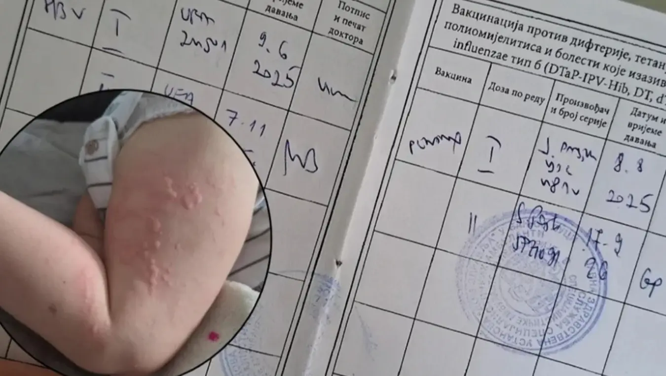 Дјетету у Бањалуци грешком дата погрешна вакцина